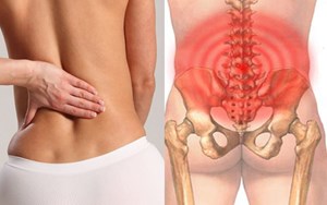 HỘI CHỨNG ĐAU THẮT LƯNG NGUY HIỂM TIỀM ẨN ĐẰNG SAU