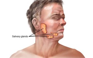 UNG THƯ TUYẾN NƯỚC BỌT KHÔNG BỎ SÓT MỘT AI!
