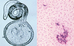 BỆNH TOXOCARA VÀ NHỮNG ĐIỀU CẦN BIẾT