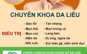NỐT RUỒI VÀ NHỮNG ĐIỀU CẦN BIẾT