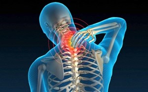 BỆNH THOÁI HÓA CỘT SỐNG CỔ BIẾN CHỨNG NGUY HIỂM!