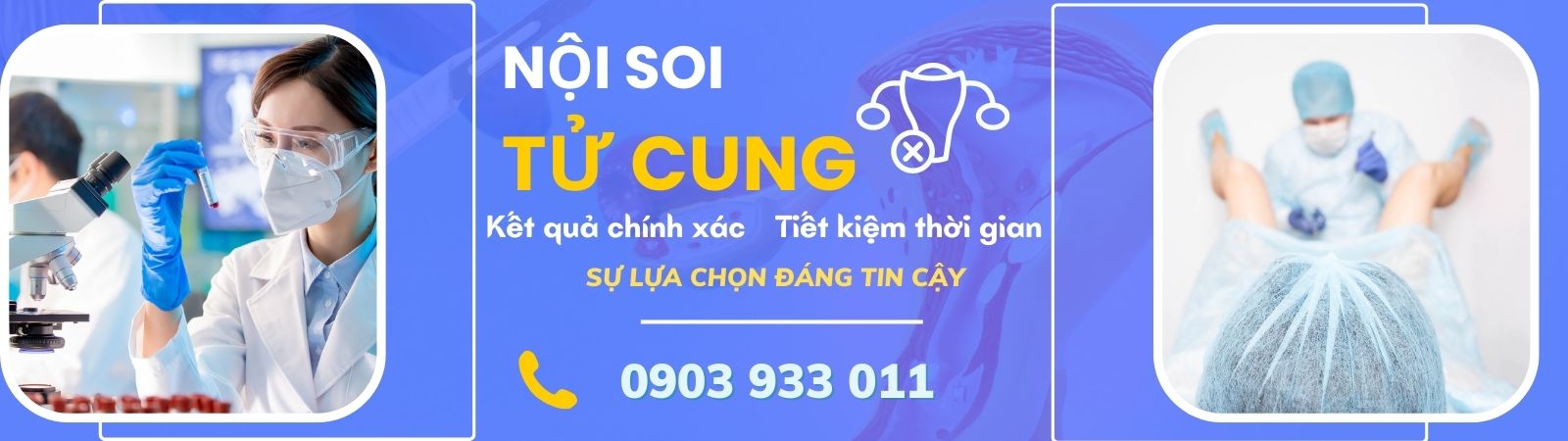 SOI CỔ TỬ CUNG