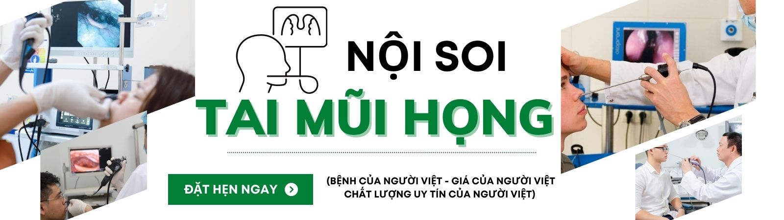 NỘI SOI TAI MŨI HỌNG