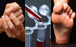 CK 006 Gói xét nghiệm chẩn đoán bệnh khớp