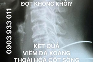 ĐAU MỎI VAI GÁY CHÓNG MẶT Ù TAI KÉO DÀI ĐIỀU TRỊ NHIỀU ĐỢT KHÔNG KHỎI! LÀ BỆNH GÌ? CÓ NGUY HIỂM KHÔNG?