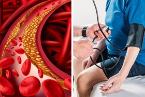 7 chứng bệnh nguy hiểm gây béo phì