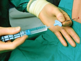 Gây tê tủy sống khi sinh: Tác hại và cách khắc phục