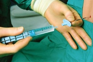 Gây tê tủy sống khi sinh: Tác hại và cách khắc phục