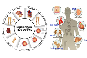 9 triệu chứng sớm của bệnh tiểu đường ai cũng phải biết để nhận ra kịp thời