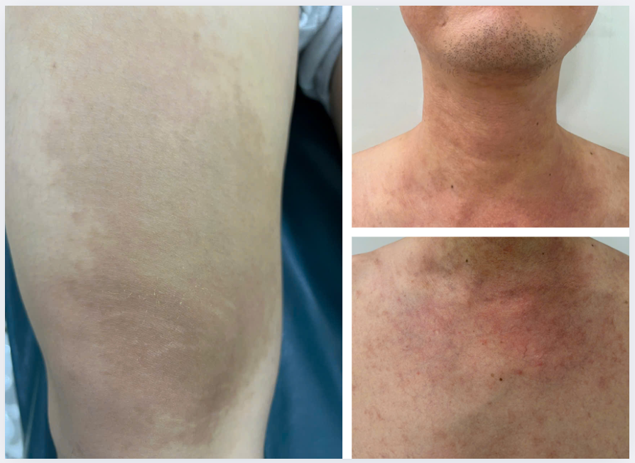 Khám sức khỏe tổng quát phát hiện bệnh sán chó - Anh Thu sinh năm 1994 tại Quận 12